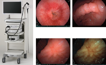 内視鏡検査装置